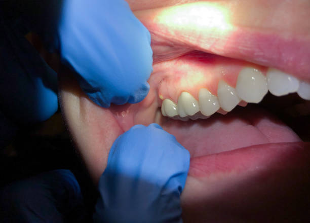 Best Emergency TMJ Treatment in Mulvane, KS